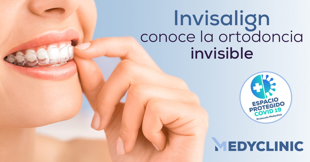 Invisalign-ortodoncia-invisible
