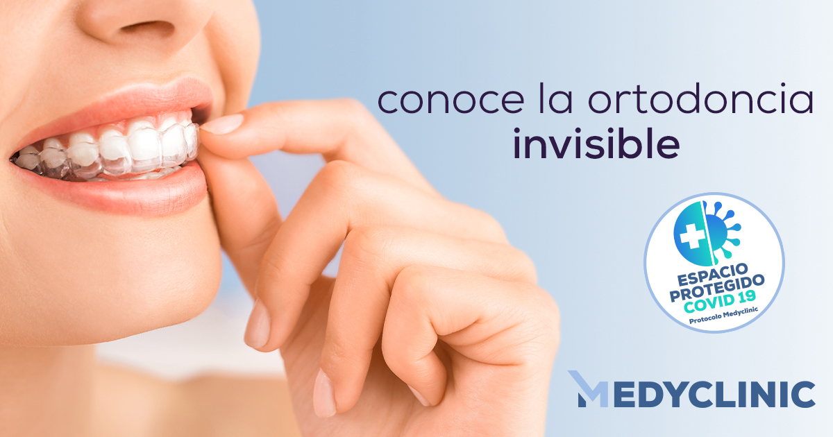 RETENEDORES-ortodoncia-invisible