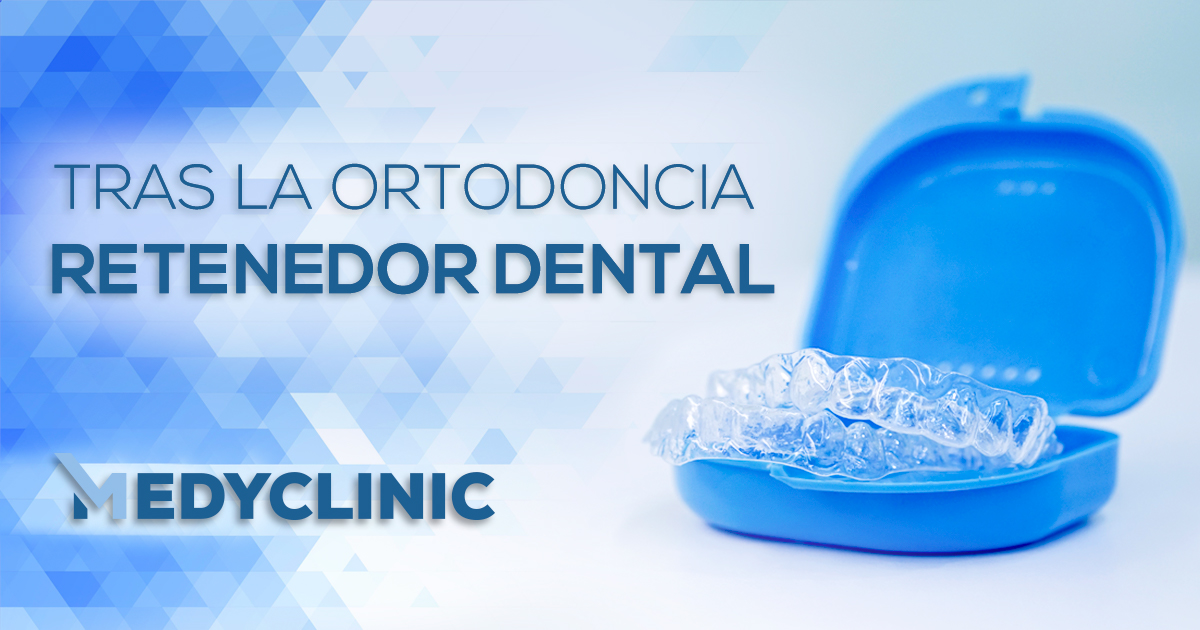 Retenedor-dental-1200x630-1