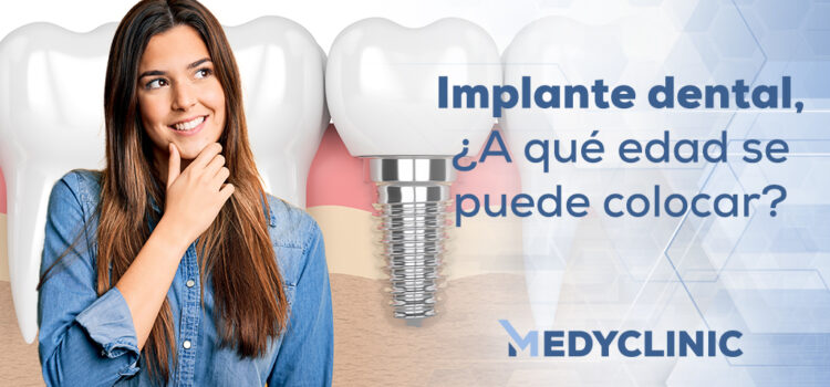 colocacion-implantes-dentales