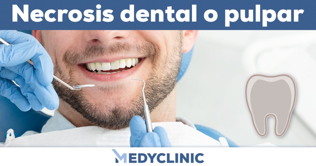 ¿Qué es la necrosis dental? Medyclinic